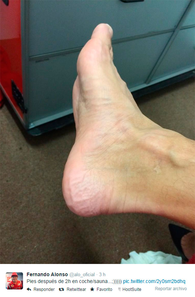 pies-fernando-alonso-marina-bay